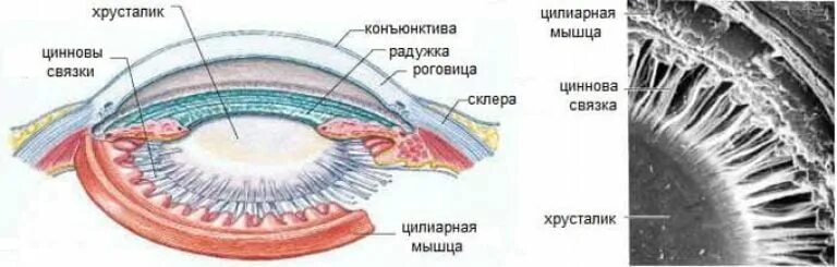 Мышца хрусталика цилиарная мышца. Строение цилиарной мышцы глаза. циннова связка хрусталика. анатомия хрусталика циннова связка. ресничное тело глаза строение.