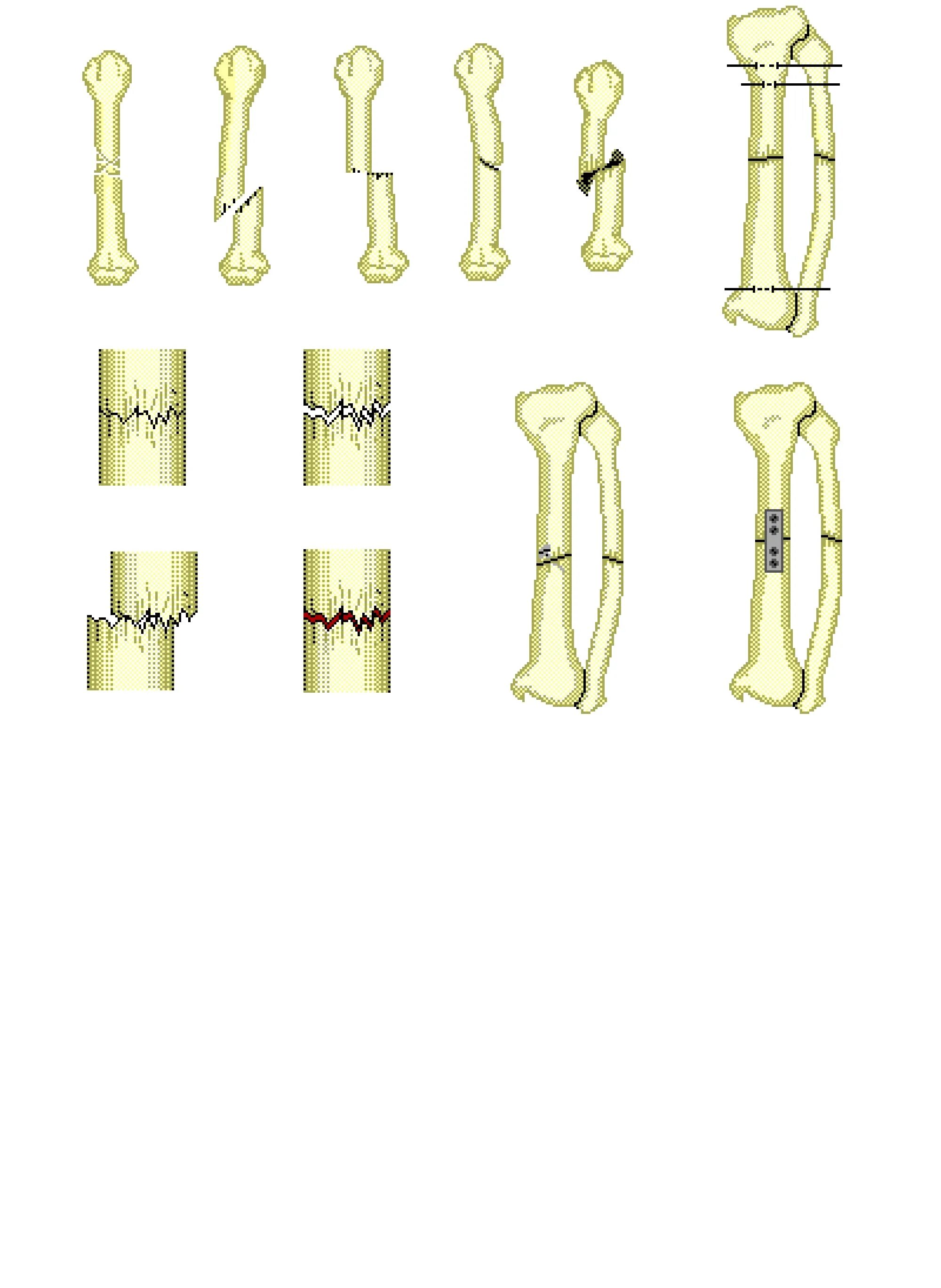 Fracture modeling. Fracture modeling