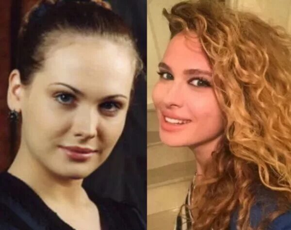 Анна горшкова до и после пластики Анна Горшкова биография, фото до и после пластики новости селебрити Дзен