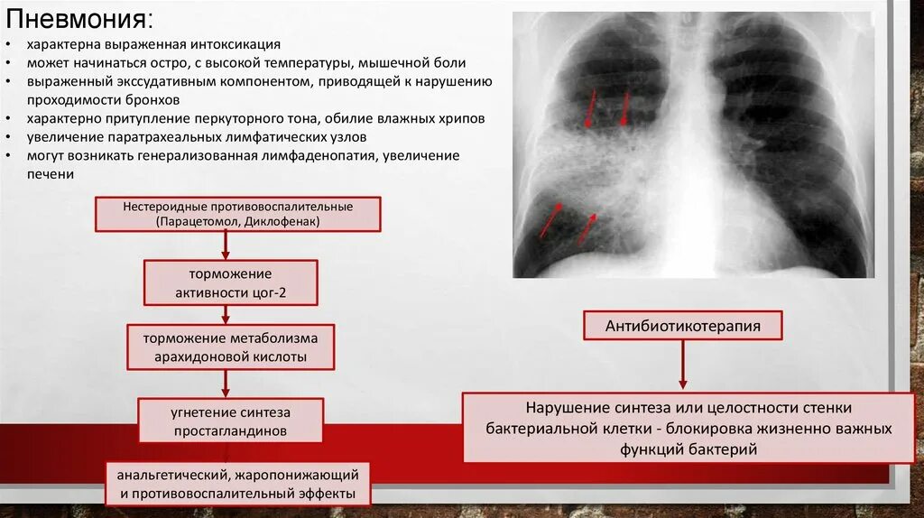 Для пневмонии характерно. Воспаление легких температура. Пневмония интоксикация. При воспалении легких есть температура