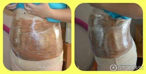 месячные и обертывания. Flex body холодное обертывание. обертывание детокс фукус. обёртывание от целлюлита. обёртывание для похудения антицеллюлитный.