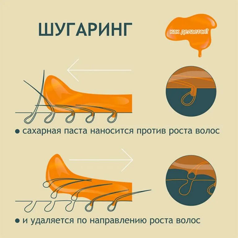 Схема шугаринга. Схема направления роста волос для шугаринга. Техники шугаринга. Шугаринг по росту волос. Депиляция воском против роста или по росту