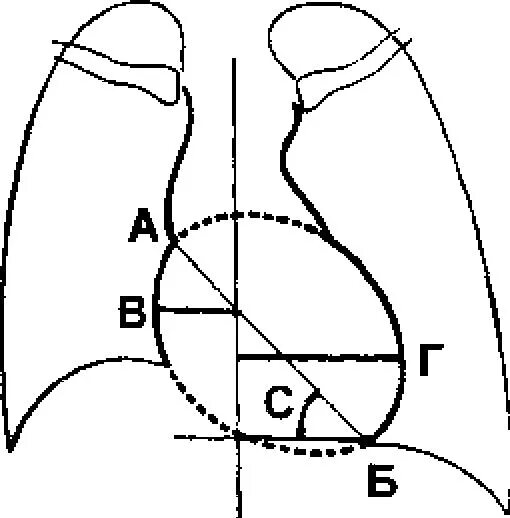 Длинник и поперечник сердца. Размер поперечника сердца в норме. Длинник сердца. Поперечник и длинник сердца на рентгенограмме схема. Длинник и поперечник