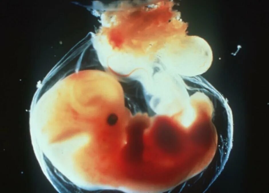 Эмбрион на 4 неделе беременности. Плоду 4 недели фото. Эмбрион на 4 неделе беременности. 4 неделя развития зародыша. 5-embrion.