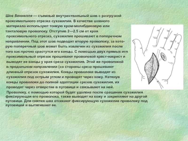 Операции на нервах и сухожилиях