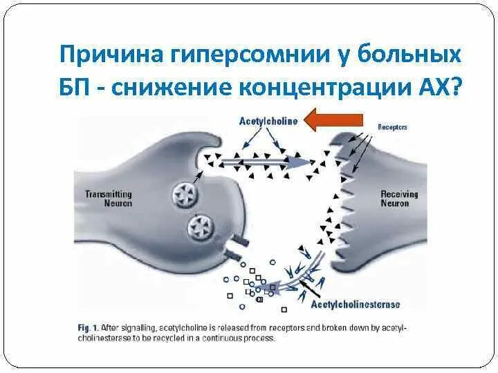 Гиперсомния причины. Идиопатическая гиперсомния. Причиной психофизиологической гиперсомнии является. Причины гиперсомнии. Гиперсомния физиология.