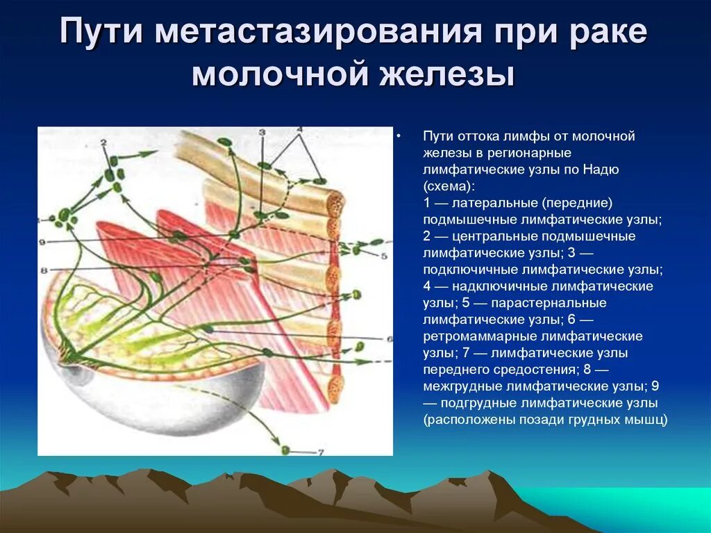 Пути метастазирования молочной железы. Пути метастазирования РМЖ. Пути метастазирования опухоли молочной. Регионарные лимфатические узлы. Лимфоузлы при рмж