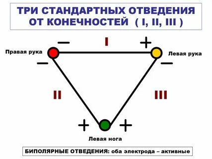 Правые отведения
