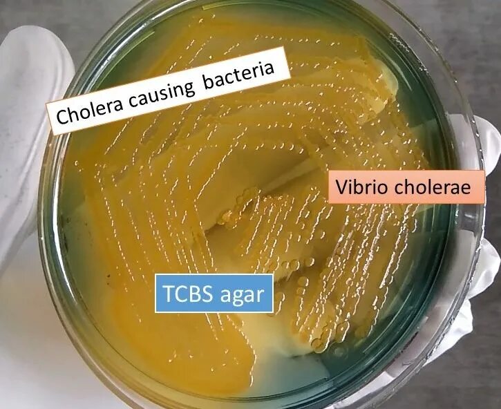 Холера питательные среды. TCBS агар. TCBS агар холерный вибрион. TCBS агар микробиология. Колонии холерного вибриона на щелочном агаре.