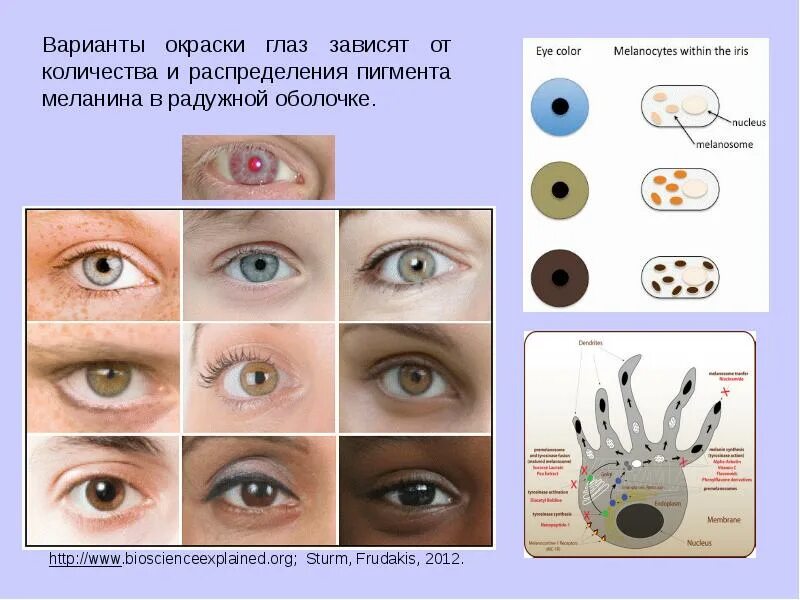 Отсутствие пигмента в радужке глаз. Меланин цвет глаз. Меланина в радужной оболочке глаза. Радужка содержит пигмент