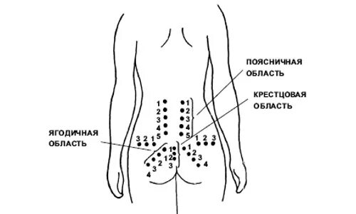 Схема боли в спине. Схема массажа пояснично-крестцового отдела позвоночника. Массаж пояснично-крестцового отдела схема. Акупунктурные точки при боли в пояснице. Точечный массаж пояснично-крестцового отдела.