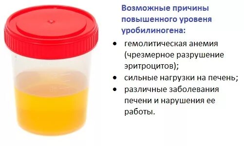 Уробилиноген в моче что это у мужчин. Норма уробилиногена в моче показатели. Уробилин в моче. Повышение уробилина в моче. Повышение уробилиногена в моче причины.