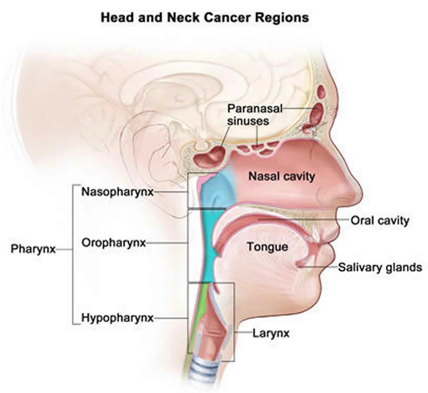 Cancer of the pharynx and larynx.