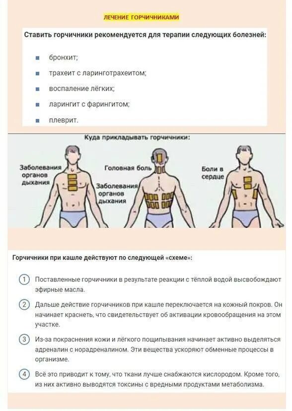 Сколько держать горчичники детям. Схема расположения горчичников при бронхите. Как надо правильно ставить горчичники при кашле. Места постановки горчичников при бронхите пневмонии. Места постановки горчичников при бронхите.