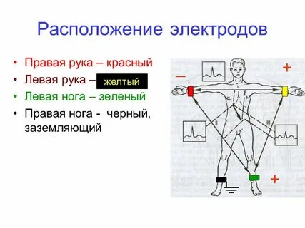 Экг красный желтый зеленый