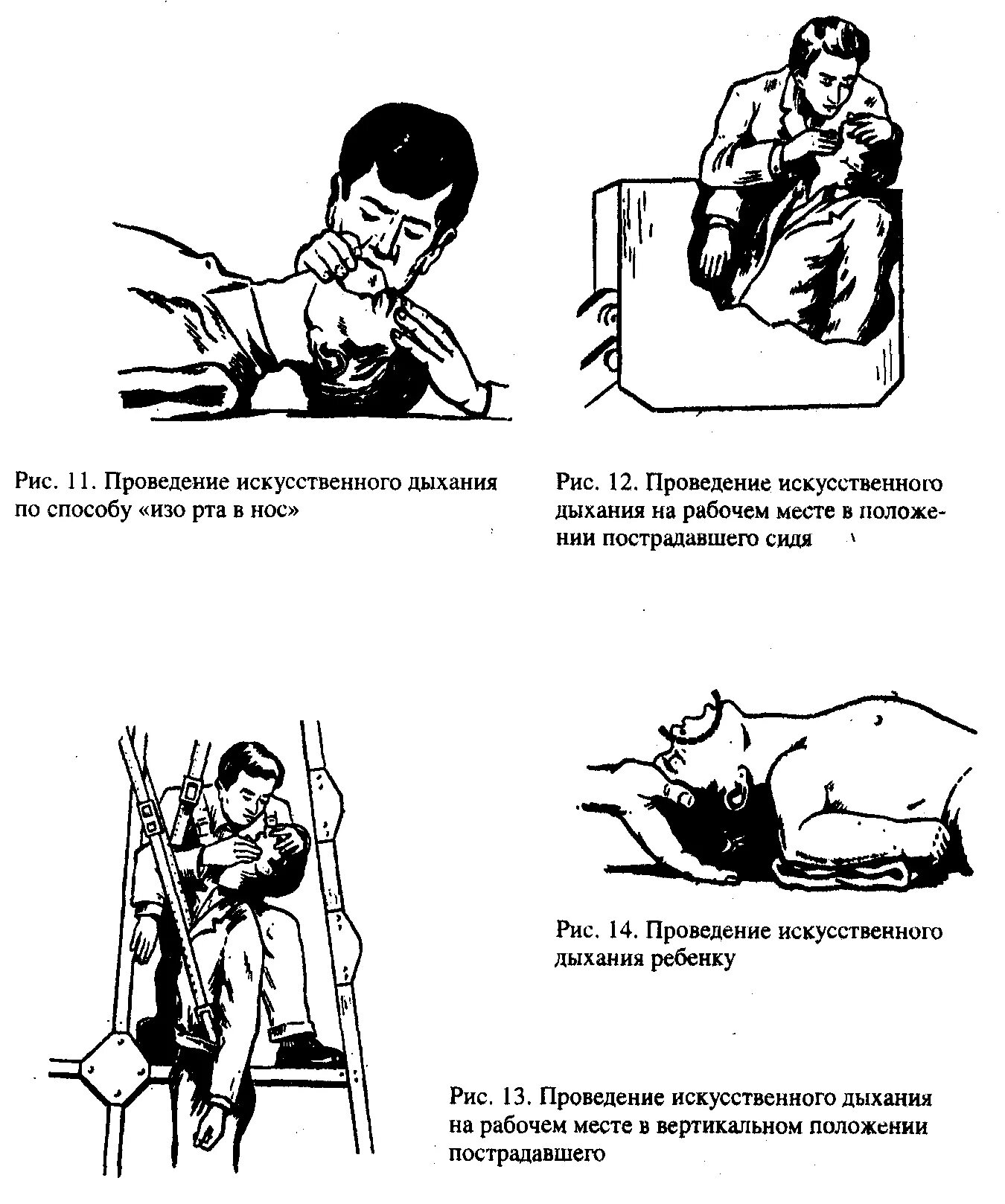 Искусственное дыхание проводится в случаях. Положение при искусственном дыхании. Способы искусственного дыхания. Положение пострадавшего при проведении искусственного дыхания?. Положение пациента при проведении искусственного дыхания.