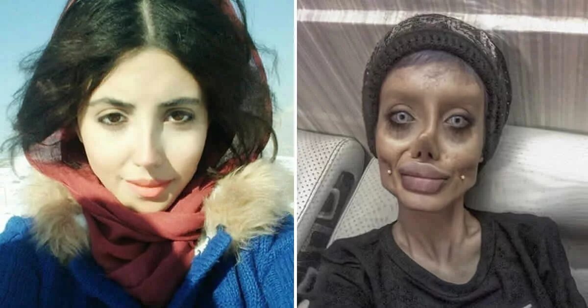 Сестра после операции. Иранка похожая на Анджелина Джоли. Иранская табар Анджелина Джоли.