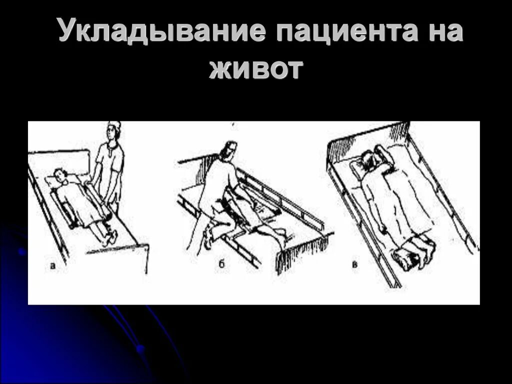 Укладывание пациента на живот. Укладывание пациента на живет. Положение пациента на животе. Размещение пациента на животе.