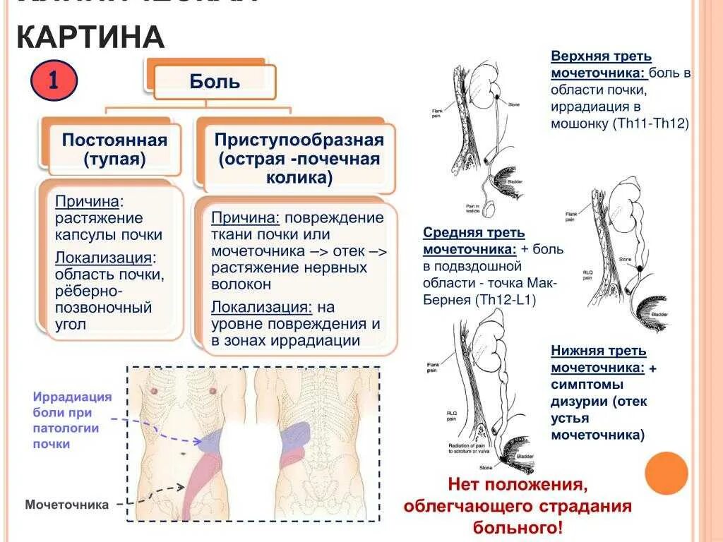 Боль в области почки справа