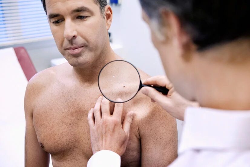 кожные заболевания половых органов у мужчин. мужской пол заболевания. мужские заболевания урология распространенные. мужской пол заболевания. презик.