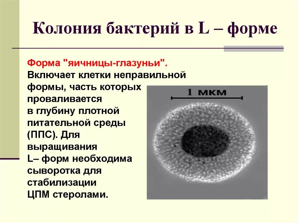 S форма бактерий. L формы бактерий. Формы колоний бактерий микробиология. Л И Р формы бактерий. S форма колоний бактерий микробиология.