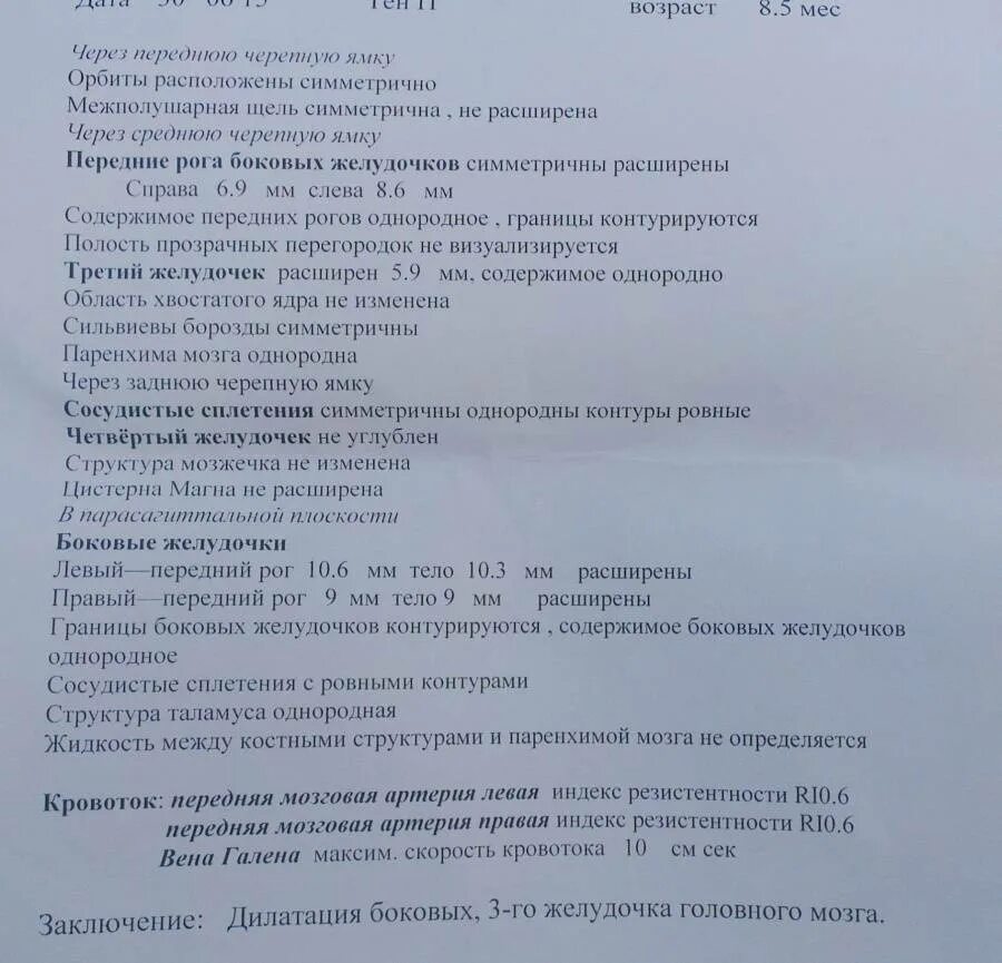 Расширение желудочков у новорожденного