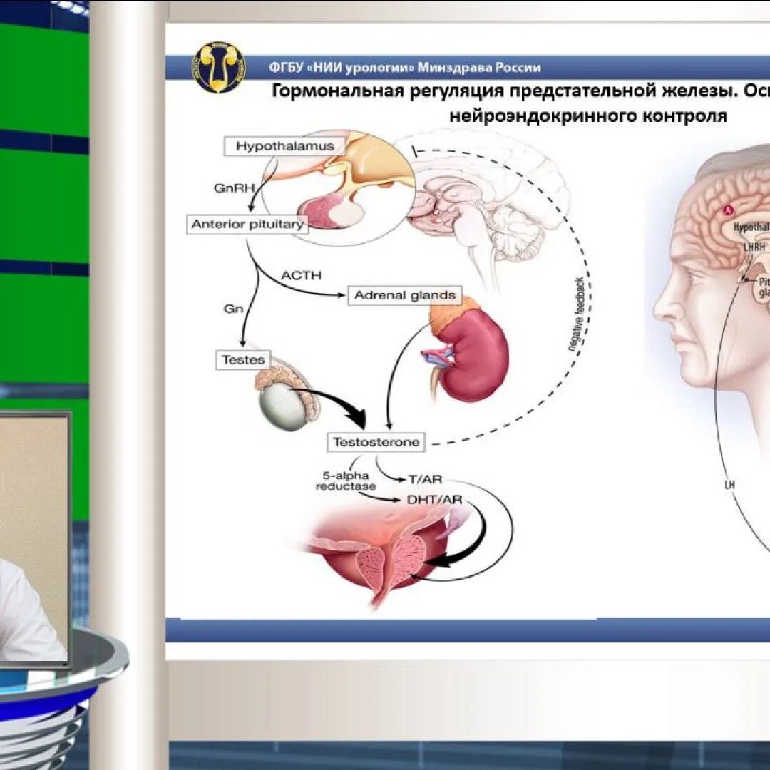 Урология минздрав. Гормональная регуляция предстательной железы. Механизм гормональной регуляции предстательной железы. Уролог предстательная железа. Простатит презентация урология.
