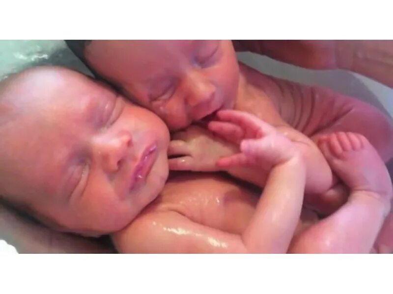 Когда начинают видеть новорожденные после рождения. Мир глазами новорожденного. Как видят Новорожденные. Новорожденные видят глаза. Как начинает видеть новорожденный ребенок.