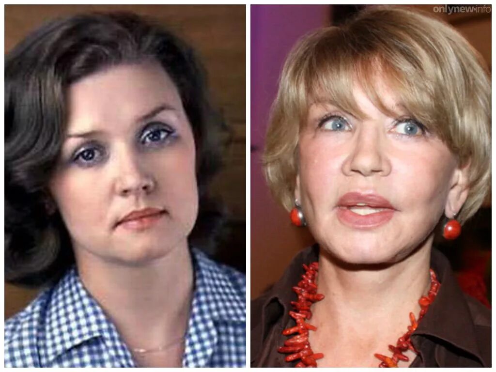 вера алентова пластика. вера алентова после пластики неудачной. вера алентова фото после пластики. вера алентова сейчас 2021. алентова после неудачной пластики.