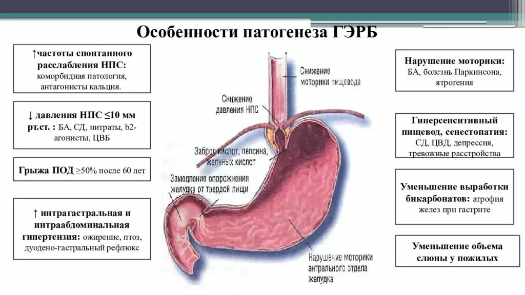 Классификация рефлюкса. Клинические проявления рефлюкс эзофагита. Газоэзофагальнаярефлюксная болезнь. Рефлюксная болезнь желудка рефлюкс. Гастроэзофагеальная рефлюксная болезнь симптомы.