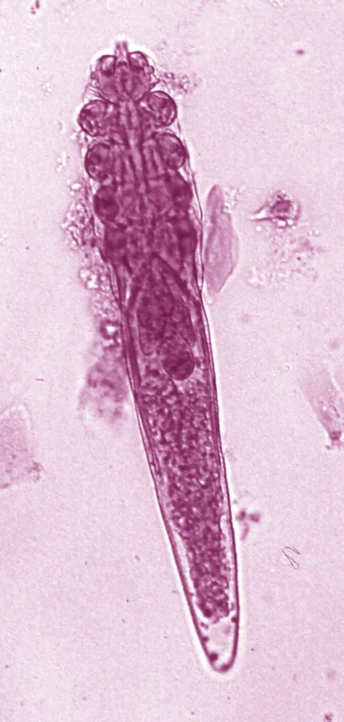 Железница угревая - клещ паразитология. Железница угревая Demodex folliculorum