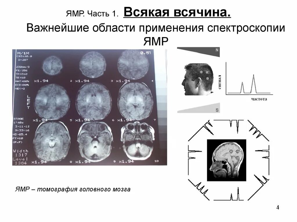 Спектроскопия магнитного резонанса