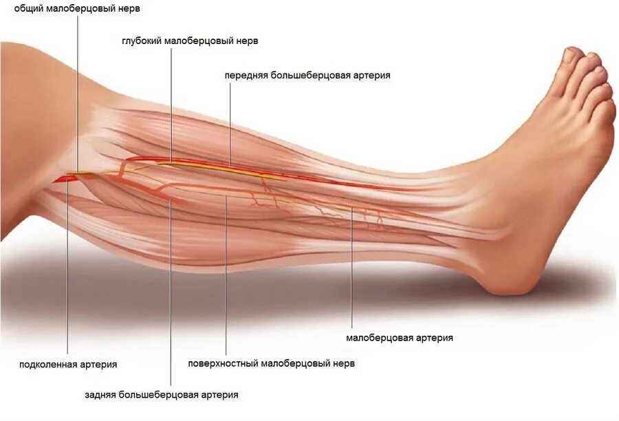 Невропатия стопы. Поверхностный малоберцовый нерв. Поверхностный малоберцовый нерв иннервирует. Неврит малоберцового нерва анатомия. Общий малоберцовый нерв ветви.