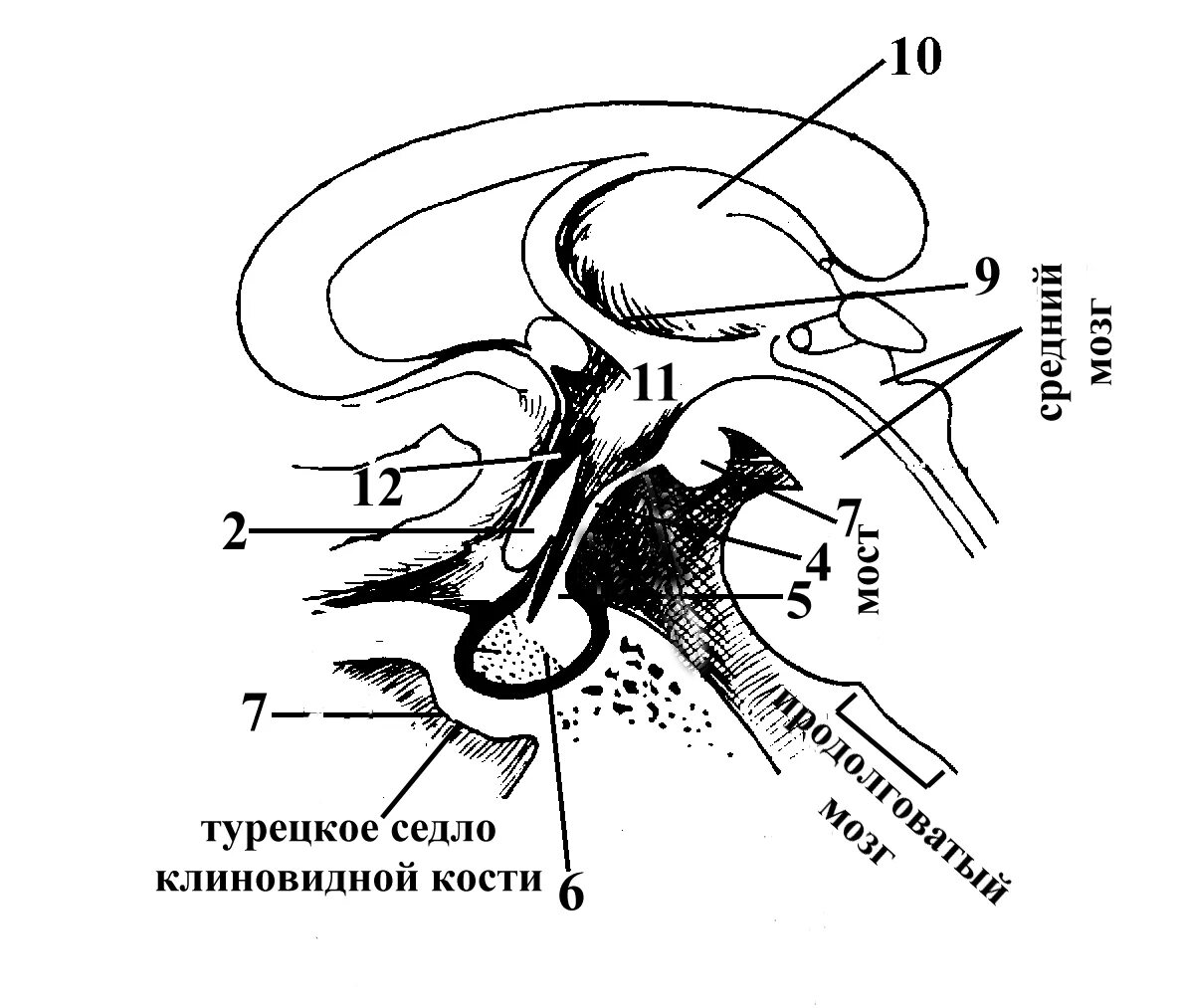 Турецкие седло кость. Гипофиз в турецком седле. Сагиттальный разрез мозга турецкое седло. Строение мозга турецкое седло. Гипоталамус на сагиттальном разрезе.