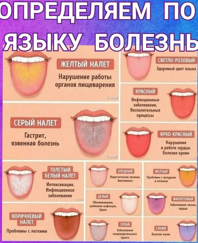 Язык человека определить болезнь. Заболевания по цвету языка. Болезни по языку схема. Выявление заболевания по языку.