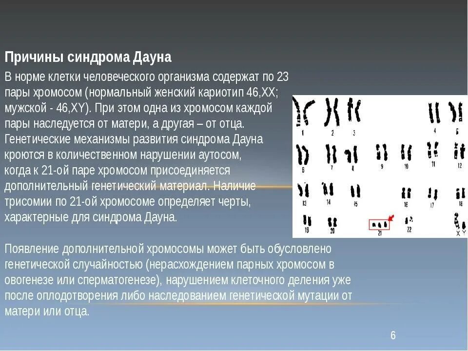 Болезнь дауна причины. Механизм возникновения синдрома Дауна. Транслокационный синдром Дауна кариотип. Кариотип человека с болезнью Дауна. Болезнь Дауна кариотип.