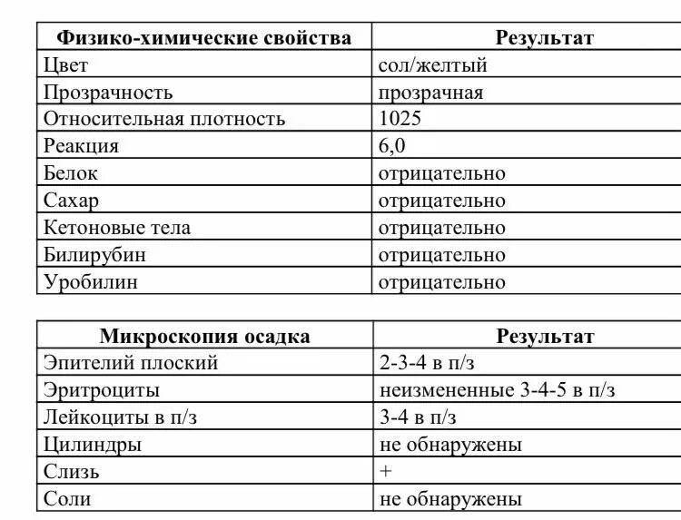 Общий мочи норма и расшифровка. Общий анализ мочи расшифровка у женщин. Общий анализ мочи расшифровка у мужчин. Расшифровка ОАМ У взрослых таблица. Расшифровка ОАМ У женщин.