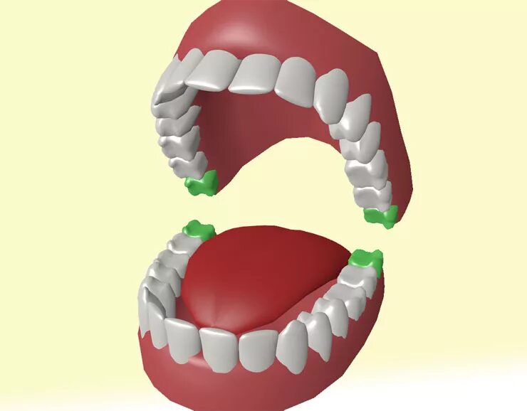Зубы восьмерки это какие. Восьмерка зубов в стоматологии.