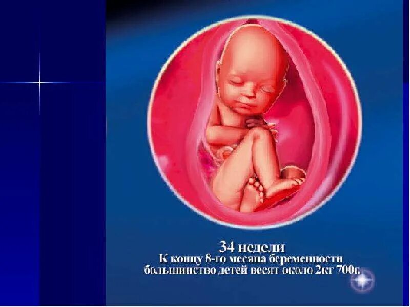 Как выглядит беременность в 34 недели