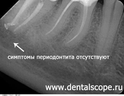 Пропускает каналы