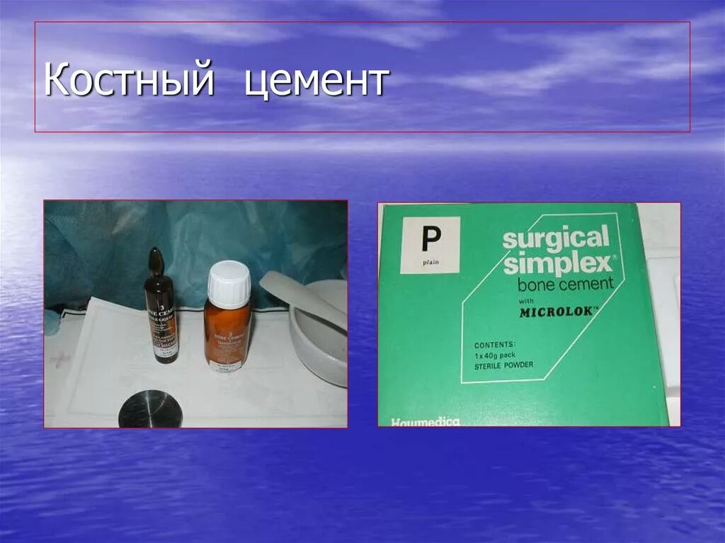 Костный цемент cemex. Палакос костный цемент. Bone cement. Медицинский цемент для кости. Цемент surgical simplex p.