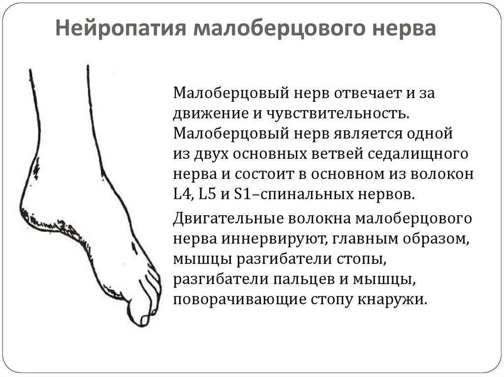 Походка степпаж
