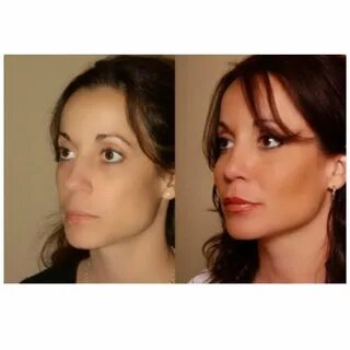 Пластические изменения