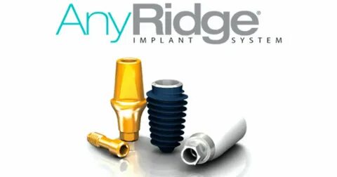 Anyridge импланты