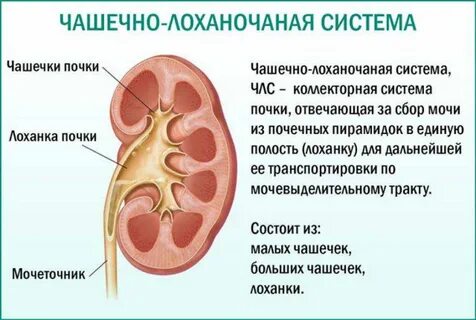 Расширена чашечно лоханочная система почек