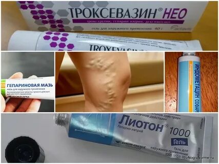 Мазь от варикоза для женщин