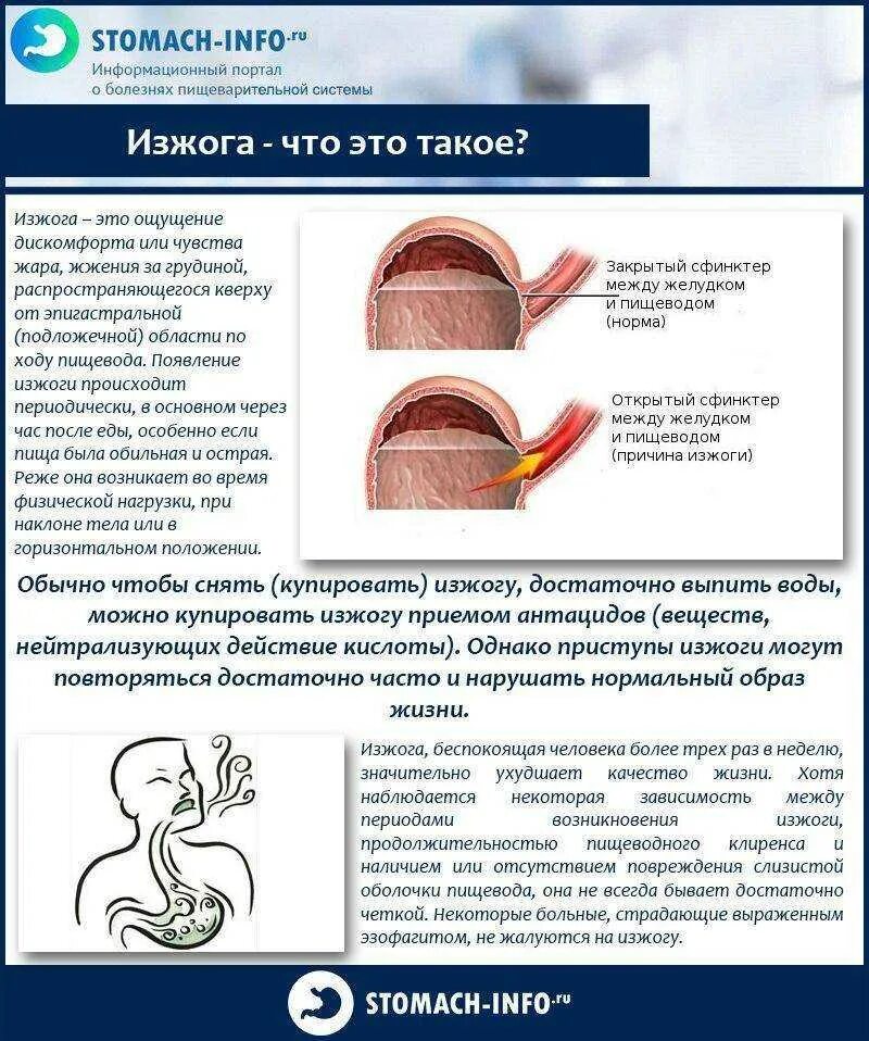 Изжога причины. Причины возникновения изжоги.