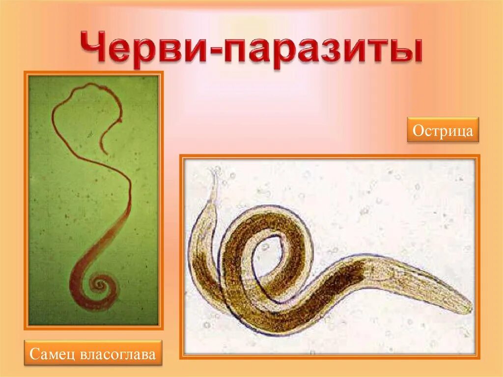 Круглые черви огэ. Трихинелла острица власоглав. власоглав круглые черви. круглые черви паразиты власоглав. аскарида, трихинелла, острица, власоглав.