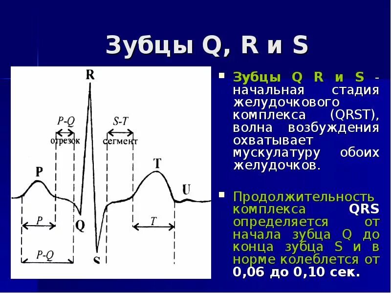 Комплекс QRST на ЭКГ. Нормальная Продолжительность комплекса QRS составляет. Амплитуда комплекса QRS В норме. ЭКГ амплитуда комплекса QRS.