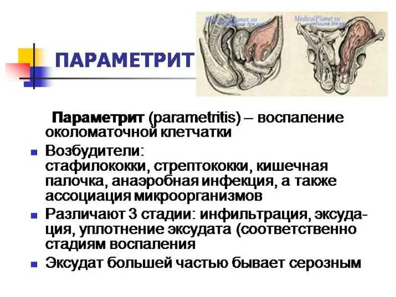 Параметрий это